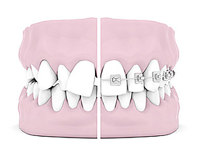 Fotolia_61695031_XS_ORTO