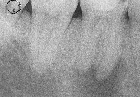 endodonzia 5