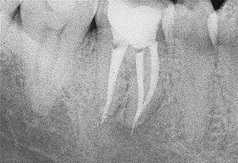 endodonzia 5