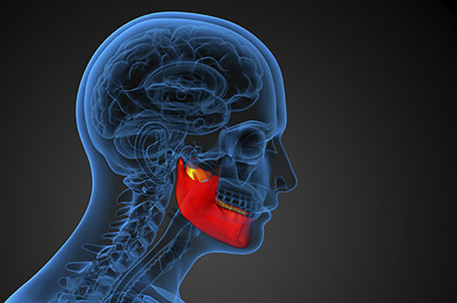 Gnatologia bite: per disturbi dell'apparato masticatorio