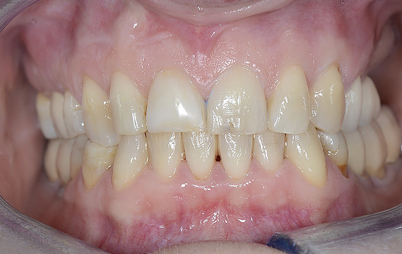 73644 170131_servizi