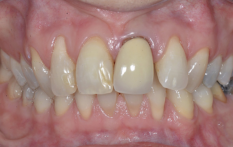 73644 170131_servizi